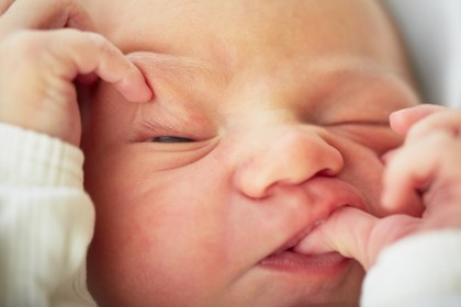 Iritatii si semne din nastere pe piele la nou-nascut