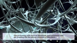 MatriDerm - Procedura de regenerare a tesutului intr-un singur pas