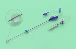 Softinjector – injector uterin moale pentru histerosalpingografie