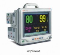 Monitor AnyView A6