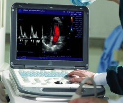 Ecograf Color Mindray M5