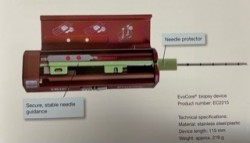 ACE BIOPSIE MAMARA AC BIOPSIE HEPATICA  BIP GERMANIA