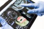 10 Mituri despre implantul dentar în care mulți români încă mai cred