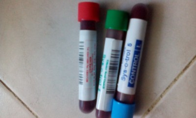 SANGE DE CONTROL 5 DIFF-ABX Pentra, Dirui, Sysmex SF300, Beckman Coulter AcT 5diff- SYS-O-TROL 5