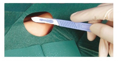 Camp operator steril, Adeziv cu Orificiu 2straturi