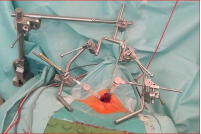 Retractor tiroidian Maxop