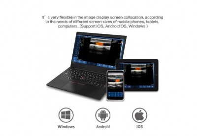 ECOGRAF PORTABIL WIRELESS COMPATIBIL CU TABLETA,TELEFON SI CALCULATOR