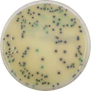 Discuri antibiograma