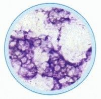 Set lame tesuturi patologice I - 10 lame