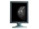 Monitor Coronis 5 MP - Barco