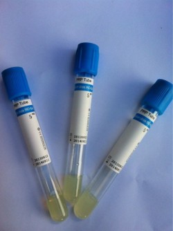 Eprubete PRP - 7 ml - de la 48 lei / buc