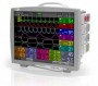 Monitor multiparametric modular FX3000MD, cu diagonala de 15" (ECG, ST, Arrhythmia Detection, Resp, SpO2, NIBP)