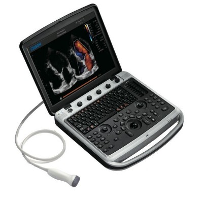 Ecograf color CHISON SonoBook 9 performant & compact