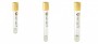 VACUTAINER BIOCHIMIE CU GEL SEPARATOR VOLUM 5 ML - PRODUCATOR KIMA / VACUTEST - DOP GALBEN