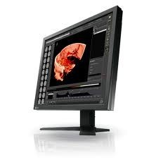 Monitor Radiforce RS110 Color LCD 1MP 48cm (19.3 inches)
