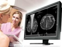 Monitor Mamografie Digitala Radiforce GS521