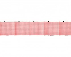 Hartie EKG la blat - 90 x 90 mm x 400 file caroiata