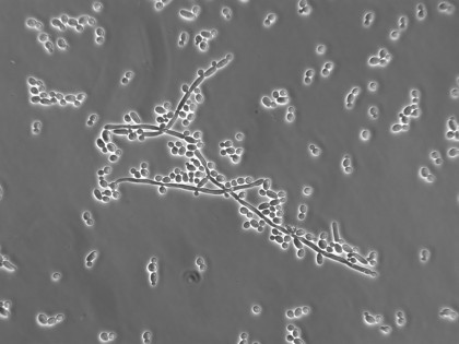 Infecțiile cu Candida - noutăți privind tratamentul