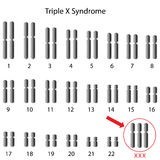 Sindrom Triplu X - Trisomia X