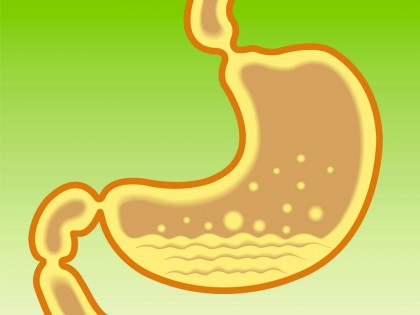 Regim reflux gastro-esofagian (pirozis)