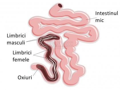 Paraziții intestinali