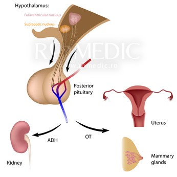 Deficitul de vasopresina (AVP, Hormonul Antidiuretic, ADH)