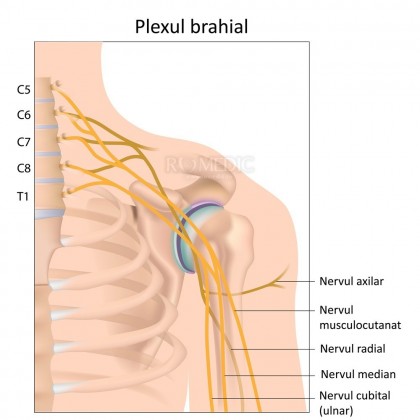 Leziunea plexului brahial