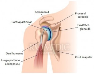 tratamentul fracturilor de cartilaj
