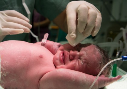 Enterocolita necrozantă