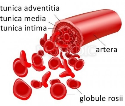 Sferocitoza ereditara