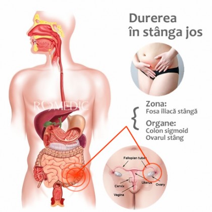 Durere în stânga jos (abdomen, burtă)