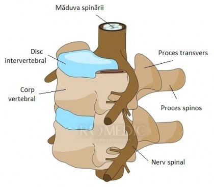 Compresiile neoplazice ale maduvei spinarii