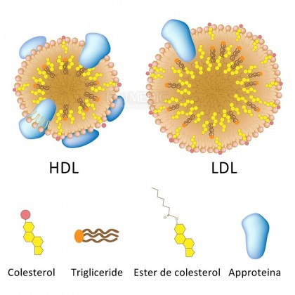 Hipercolesterolemia poligenica