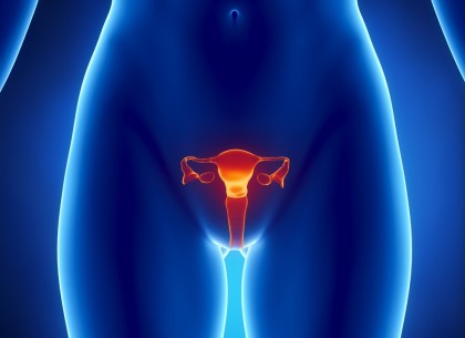 Cancer ovarian