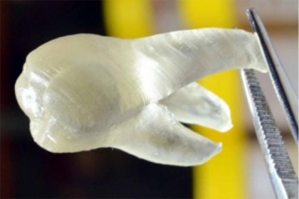 Dinții antimicrobieni printați 3D