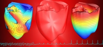 Defibrilarea optică ar putea fi utilizată pe viitor în schimbul celei cu șocuri electrice