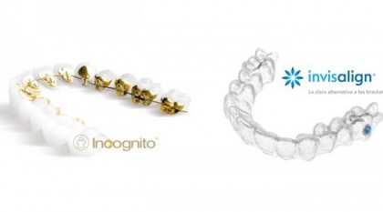 Invisalign vs. Incognito