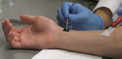 Nanocipul care vindecă țesutul afectat printr-un simplu contact