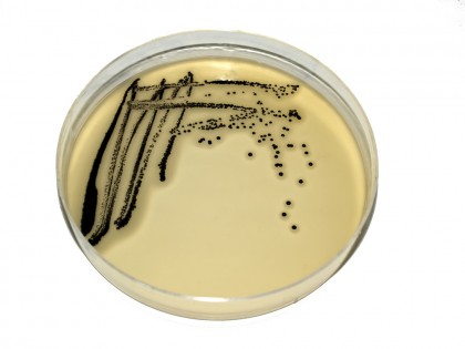 Utilizarea irațională a antibioticelor și răspândirea Stafilococului auriu meticilinorezistent