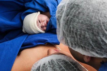 Amânarea clampării cordonului ombilical după naștere ar putea salva viața bebelușilor prematuri