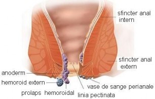 Prevenirea venelor vene la femeile gravide