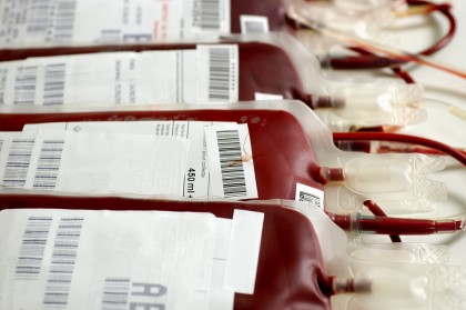 Depozitarea îndelungată a sângelui și riscurile pentru pacienții cu hemoragii masive