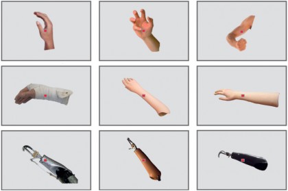 În cazul persoanelor cu proteze de braț, creierul percepe proteza ca pe mâna reală