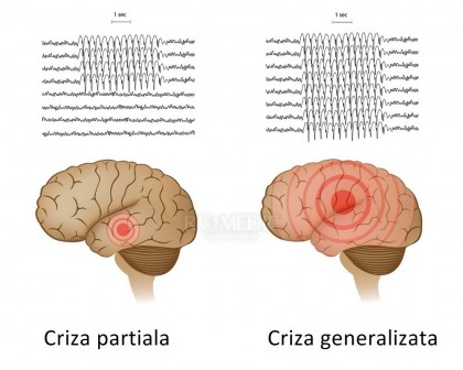 Un grup de celule din hipocamp asociate cu comoțiile și pierderile de memorie