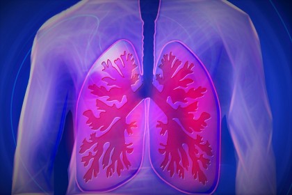 Creșterea tumorilor pulmonare încetinită la jumătate cu o nouă abordare