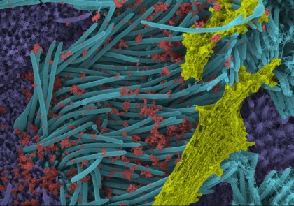 Infecția cu SARS-CoV-2 surprinsă în imagini de microscopie electronică