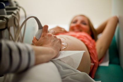 Europa. Testele prenatale au redus la jumătate numărul copiilor născuți cu sindrom Down
