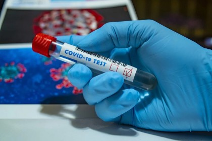 Studiu. Cercetătorii americani sugerează că testarea pentru COVID-19 ar putea fi necesară inclusiv pentru persoanele vaccinate