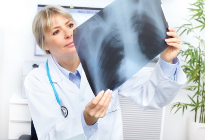 O treime dintre pacienții internați cu COVID-19 prezintă modificări pulmonare după un an
