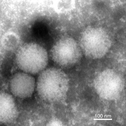 Un nou virus cu potențial de transmitere la oameni, descoperit de cercetătorii japonezi